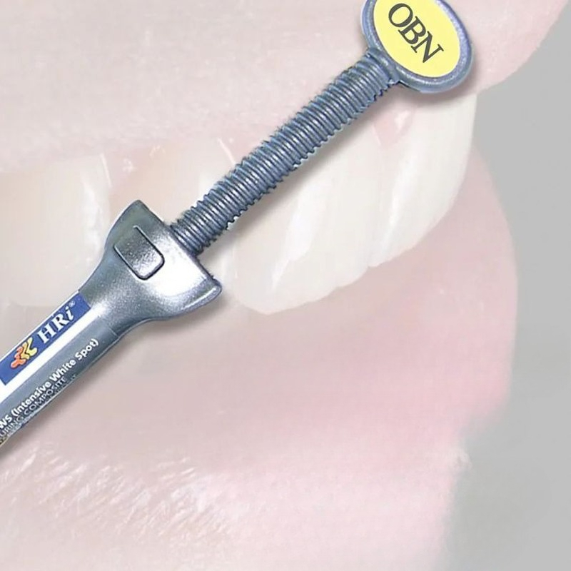 Dentalmaterialien Meisu Ästhet – Uv Resin Bewertung und Preis